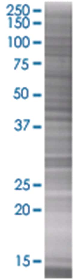 COX10 293T Cell Overexpression Lysate (Denatured), Abnova 100 &mu;l | Buy Online | Abnova | Fisher Scientific