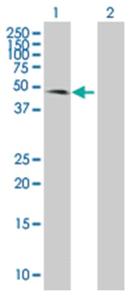COX10 293T Cell Overexpression Lysate (Denatured), Abnova 100 &mu;l | Buy Online | Abnova | Fisher Scientific