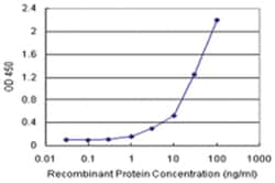 anti-CPA1 Matched Antibody Pair, Abnova