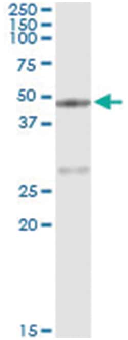 CPA1, Human, IP-WB Antibody Pair (PW2), Abnova&trade;