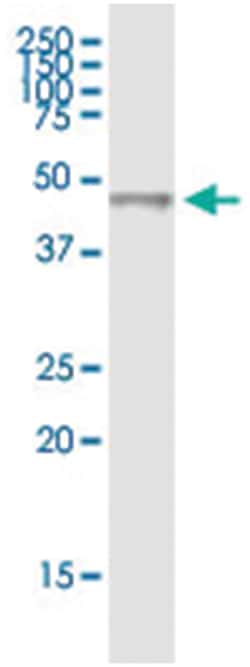 CPA1, Human, IP-WB Antibody Pair (PW3), Abnova&trade;