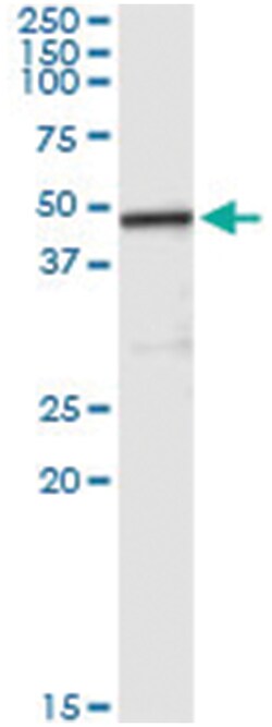 CPA2, Human, IP-WB Antibody Pair (PW2), Abnova 1 Set:Antibodies, Monoclonal/Polyclonal