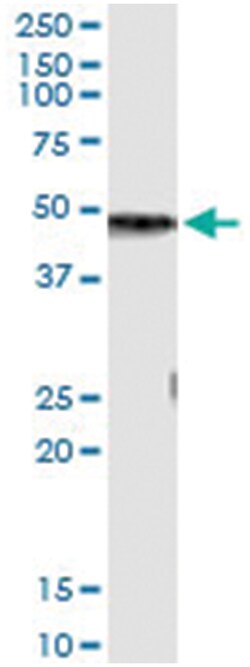 CPB1, Human, IP-WB Antibody Pair (PW2), Abnova 1 Set:Antibodies, Monoclonal/Polyclonal