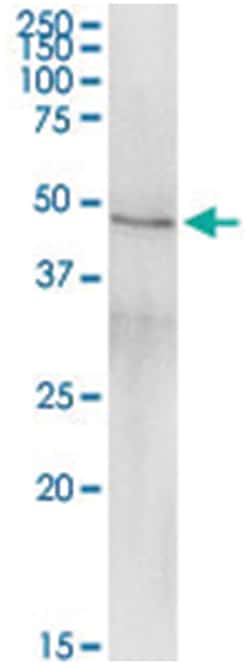 CPB1, Human, IP-WB Antibody Pair (PW3), Abnova 1 Set:Antibodies, Monoclonal/Polyclonal