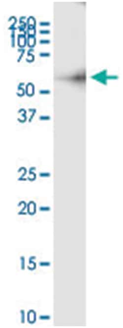 anti-CPB2, Human, IP-WB Antibody Pair, Abnova&trade;