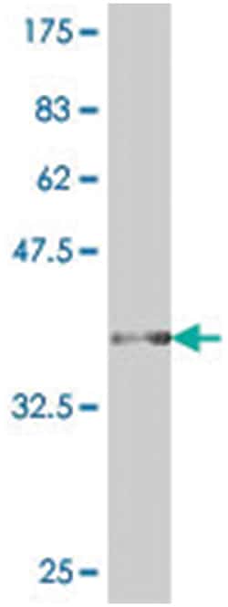 CPM, Mouse, Polyclonal Antibody, Abnova 50&mu;L; Unlabeled:Antibodies,