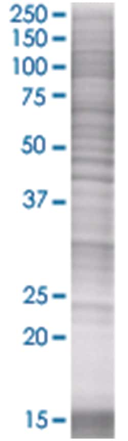 ATF2 293T Cell Overexpression Lysate (Denatured), Abnova 100 &mu;L | Buy Online | Abnova | Fisher Scientific