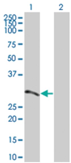 ATF2 293T Cell Overexpression Lysate (Denatured), Abnova 100 &mu;L | Buy Online | Abnova | Fisher Scientific