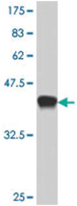 CREM, Mouse, Polyclonal Antibody, Abnova 50&mu;L; Unlabeled:Antibodies,