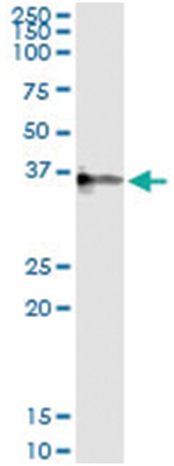 CRHBP, Human, IP-WB Antibody Pair (PW2), Abnova™