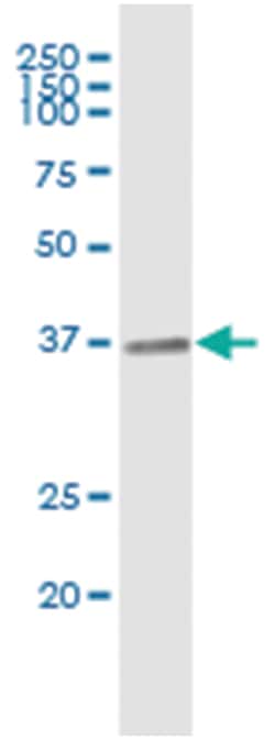 CRHBP, Human, IP-WB Antibody Pair (PW3), Abnova 1 Set:Antibodies, Monoclonal/Polyclonal