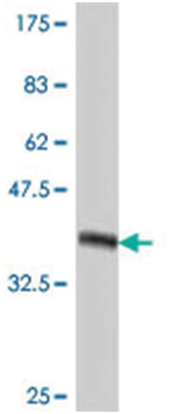 CRX, Mouse, Polyclonal Antibody, Abnova 50&mu;L; Unlabeled:Anticorps, Polyclonal