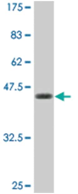 CRYGC (M01), Mouse anti-Human, Clone: 7C4, Abnova 200&mu;L; Unlabeled:Antibodies,