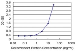 anti-CRYGD Ab-1 Matched Antibody Pair, Abnova&trade;