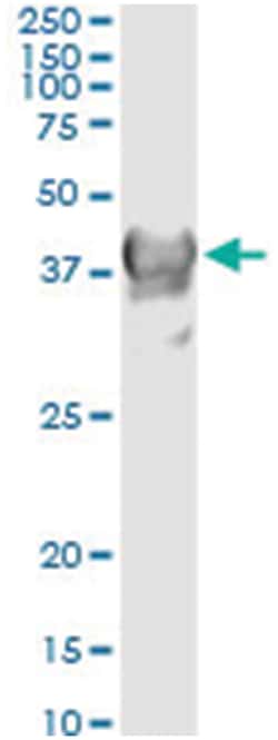 CRYM, Human, IP-WB Antibody Pair (PW2), Abnova&trade;