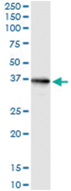 CRYM, Human, IP-WB Antibody Pair (PW3), Abnova&trade;