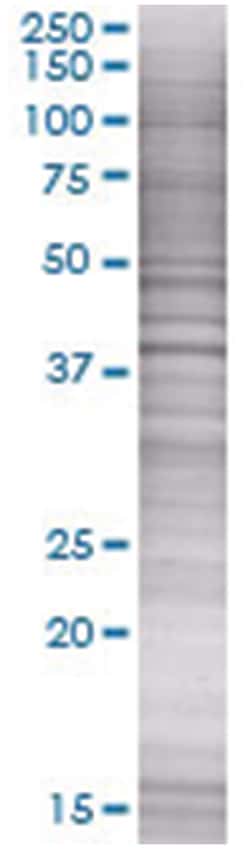 MAPK14 293T Cell Overexpression Lysate (Denatured), Abnova 100 &mu;L | Buy Online | Abnova | Fisher Scientific