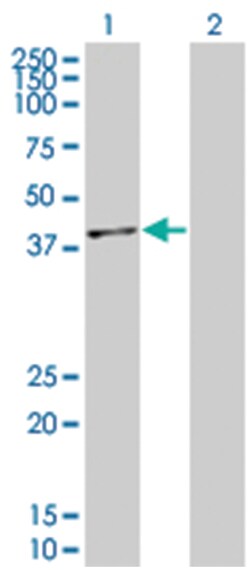 MAPK14 293T Cell Overexpression Lysate (Denatured), Abnova 100 &mu;L | Buy Online | Abnova | Fisher Scientific