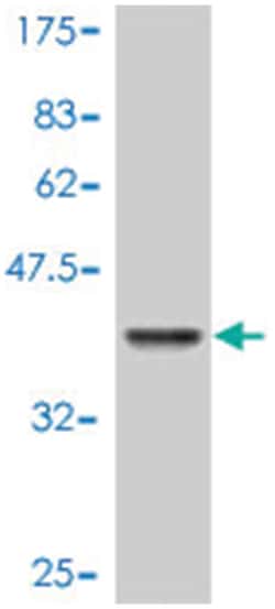 CSF1, Mouse, Polyclonal Antibody, Abnova 50&mu;L; Unlabeled:Antikörper