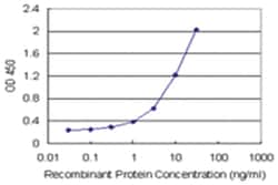 anti-CSF1 Matched Antibody Pair, Abnova