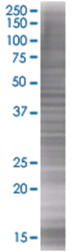 CSF1 293T Cell Overexpression Lysate (Denatured), Abnova 100 &mu;L | Buy Online | Abnova | Fisher Scientific