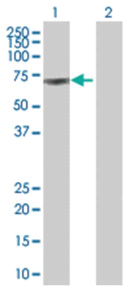 CSF1 293T Cell Overexpression Lysate (Denatured), Abnova
