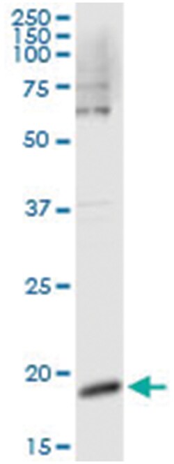 CSF3, Human, IP-WB Antibody Pair (PW2), Abnova&trade;