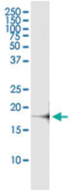 CSF3, Human, IP-WB Antibody Pair (PW3), Abnova&trade;