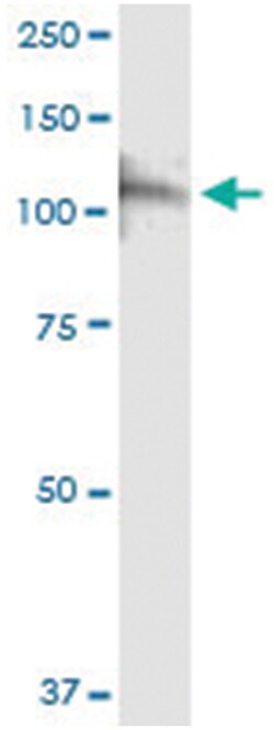 anti-CSF3R, Human, IP-WB Antibody Pair, Abnova&trade;