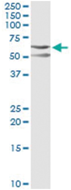 anti-CSK, Human, IP-WB Antibody Pair, Abnova 1 Set:Antibodies, Monoclonal/Polyclonal