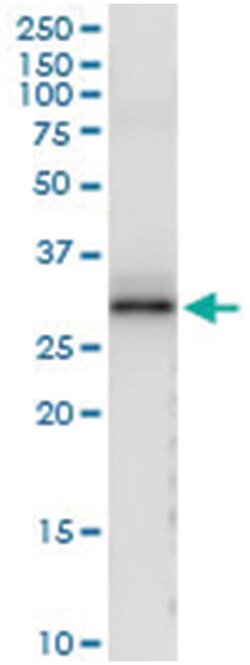 anti-CSN1S1, Human, IP-WB Antibody Pair, Abnova 1 Set:Antibodies, Monoclonal/Polyclonal