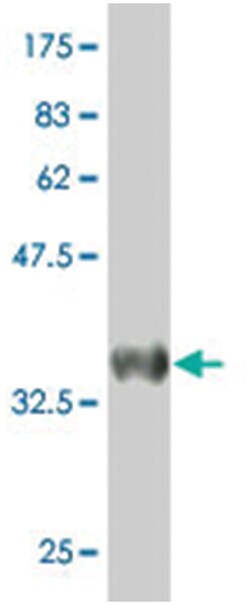 CST6, Mouse, Polyclonal Antibody, Abnova 50&mu;L; Unlabeled:Antibodies,