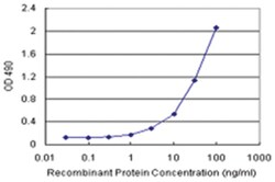 anti-CSTB Matched Antibody Pair, Abnova