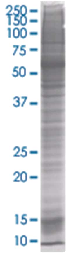 CSTB 293T Cell Overexpression Lysate 1 (Denatured), Abnova 100 &mu;L | Buy Online | Abnova | Fisher Scientific