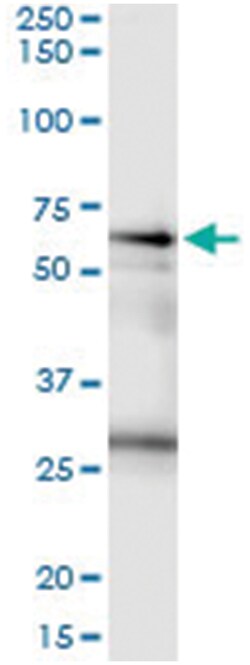 anti-CSTF2, Human, IP-WB Antibody Pair, Abnova&trade;
