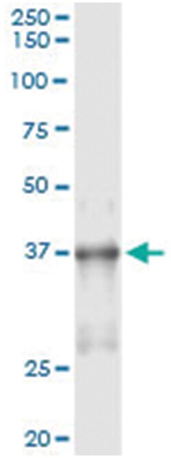 NKX2-5, Human, IP-WB Antibody Pair (PW2), Abnova&trade;