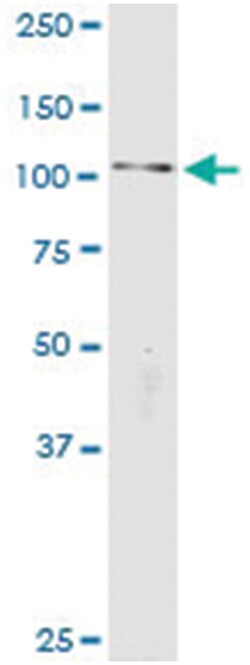 anti-CTNNA2, Human, IP-WB Antibody Pair, Abnova&trade;