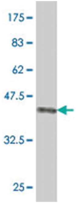 CTRL, Mouse, Polyclonal Antibody, Abnova 50&mu;L; Unlabeled:Antibodies,