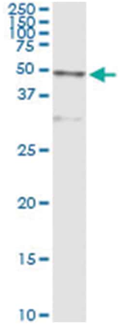 CTSD, Human, IP-WB Antibody Pair (PW2), Abnova&trade;