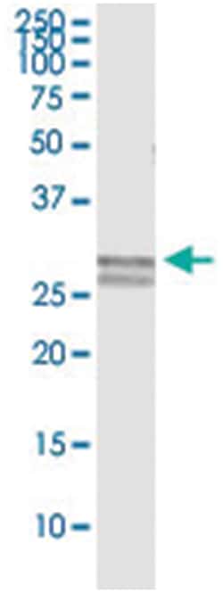 anti-CTSG, Human, IP-WB Antibody Pair, Abnova™