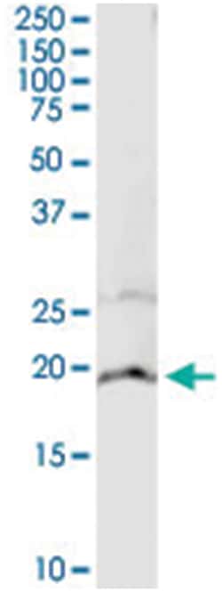 anti-CYB5A, Human, IP-WB Antibody Pair, Abnova 1 Set:Antibodies, Monoclonal/Polyclonal