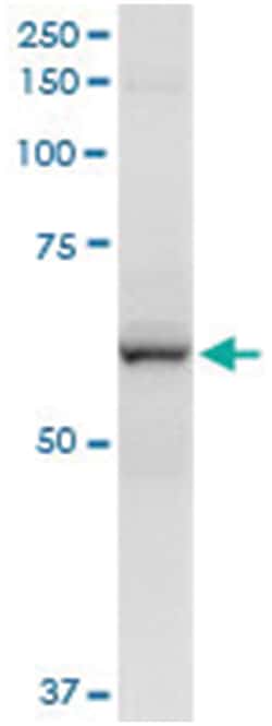 anti-CYP2A13, Human, IP-WB Antibody Pair, Abnova&trade;