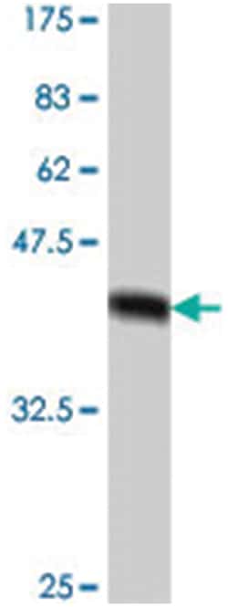 CYP2E1, Mouse, Polyclonal Antibody, Abnova 50&mu;L; Unlabeled:Antibodies,