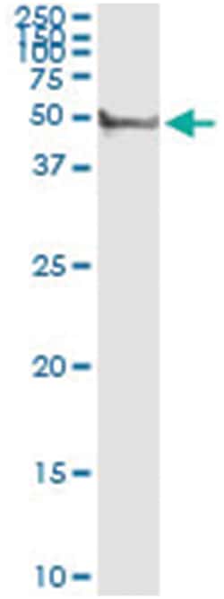 anti-CYP3A4, Human, IP-WB Antibody Pair, Abnova 1 Set:Antibodies, Monoclonal/Polyclonal