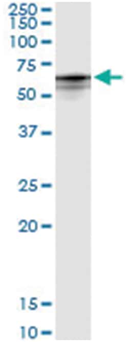 anti-CYP4B1, Human, IP-WB Antibody Pair, Abnova 1 Set:Antibodies, Monoclonal/Polyclonal