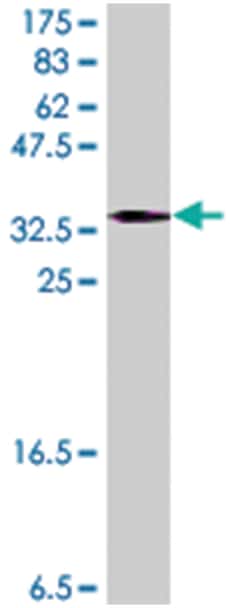 CYP24A1, Mouse, Polyclonal Antibody, Abnova 50&mu;L; Unlabeled:Antibodies,