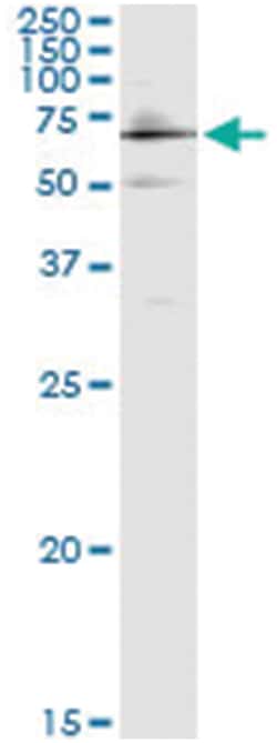 anti-CYP27A1, Human, IP-WB Antibody Pair, Abnova&trade;