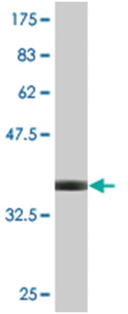 DAB2, Mouse, Clone: 1C8, Abnova 100&mu;g; Unlabeled:Antibodies, Monoclonal