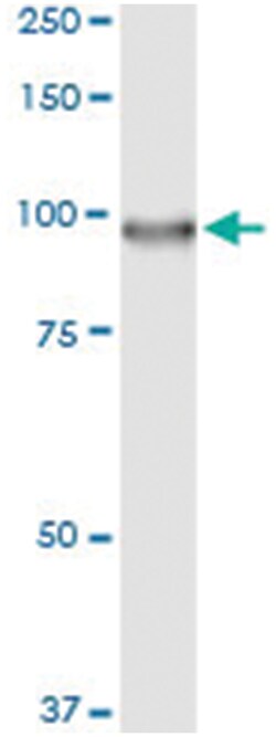 anti-DGKA, Human, IP-WB Antibody Pair, Abnova&trade;
