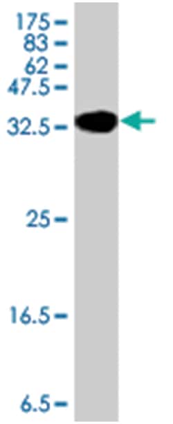 DAPK3, Mouse, Polyclonal Antibody, Abnova 50 &mu;L | Buy Online | Abnova | Fisher Scientific